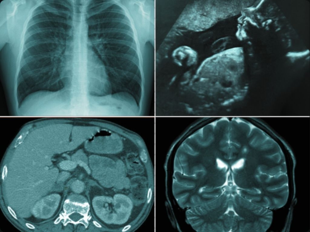 Chest radiology, MRI ...